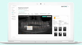 Dentomo: Программное обеспечение для распознавания стоматологических изображений